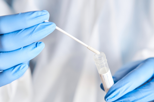 doctor putting swab into tube