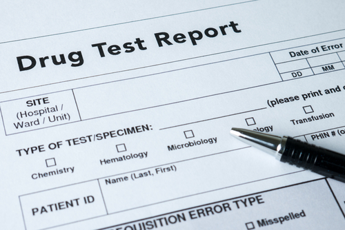 Opioid drug testing is an essential tool for detecting opioid use in individuals.