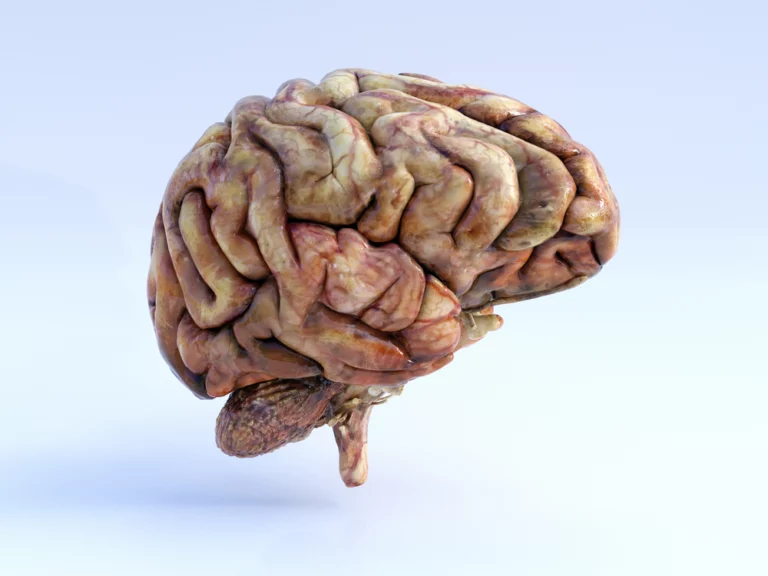 20 Dangerous Symptoms Of Wet Brain You Should Know
